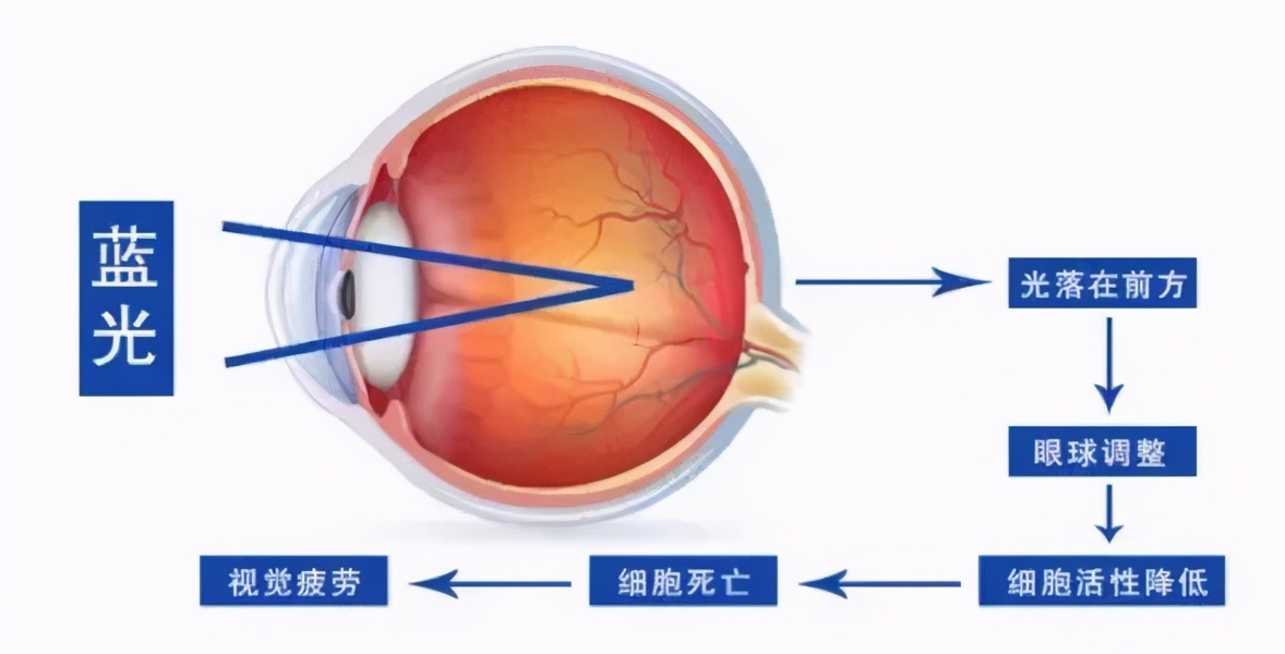 投影仪比电视对眼睛更好吗？未必